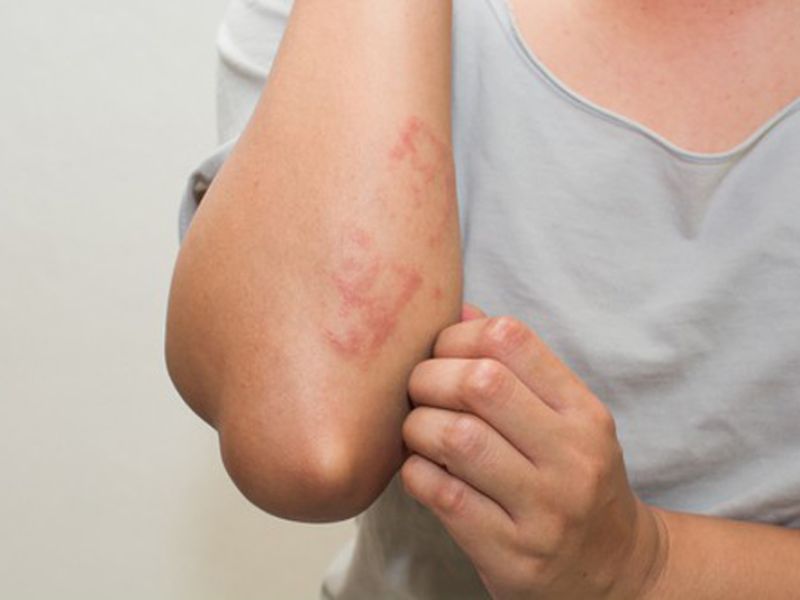 Dấu hiệu nhận biết phơi nhiễm HIV sau khi quan hệ với người bệnh Dấu hiệu nhận biết phơi nhiễm HIV sau khi quan hệ với người bệnh