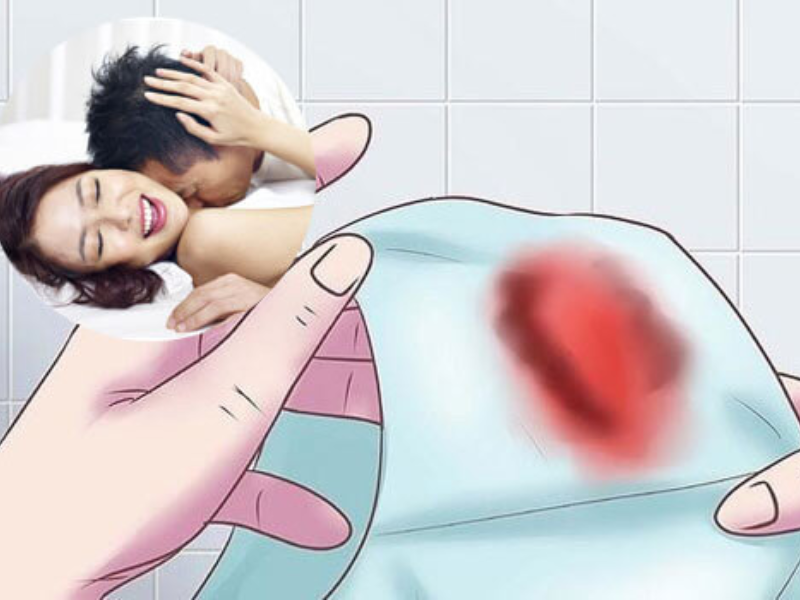 Chảy máu sau khi quan hệ có tự ngừng được không Chảy máu sau khi quan hệ có tự ngừng được không