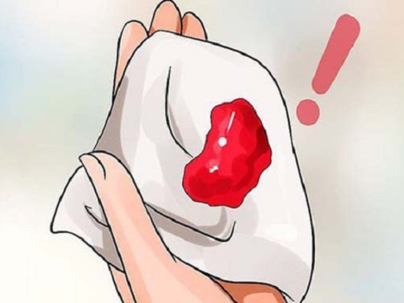 Chảy máu sau khi quan hệ tình dục có nguy hiểm không Chảy máu sau khi quan hệ tình dục có nguy hiểm không