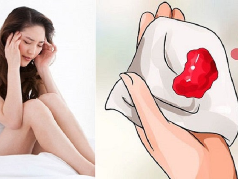 Phải làm gì khi quan hệ ra máu Phải làm gì khi quan hệ ra máu